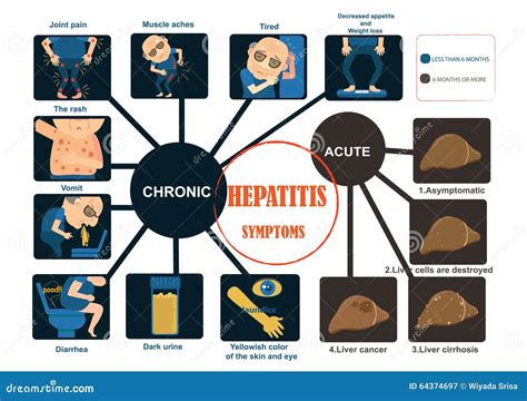 Hepatitis symptoms stock vector. Illustration of acute - 64374697