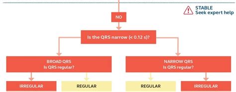 Image result for Tachyarrhythmia Algorithm