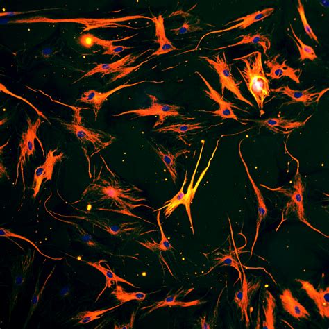 Human Dermal Fibroblasts | Life Technologies (India) Pvt. Ltd.