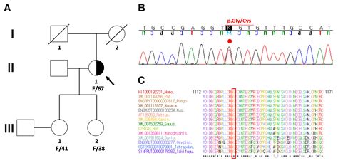 3D Printed Personalized External Aortic Root Model in Marfan Syndrome ...