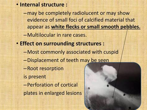 Mixed radiopaque & radiolucent lesions of jaw | PPTX