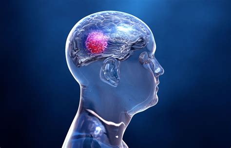 Jubilant Therapeutics gets USFDA clearance for JBI-778 to treat solid ...