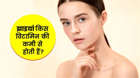 झाइयां किस विटामिन की कमी से होती है, जानें फूड सोर्स | Vitamin ...