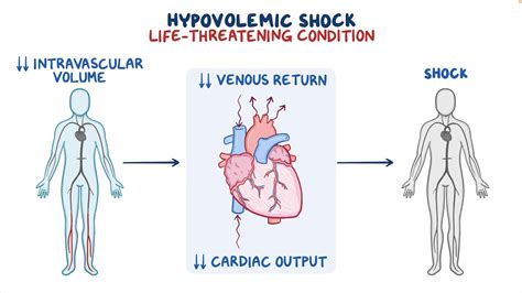 Shock Pathophysiology 的图像结果