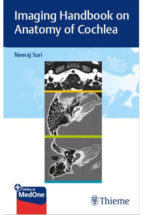 Imaging Handbook on Anatomy of Cochlea