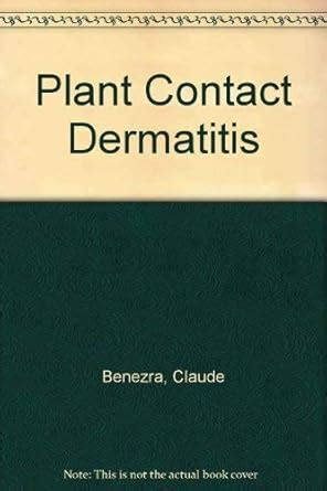 Buy Plant Contact Dermatitis Book Online at Low Prices in India | Plant ...