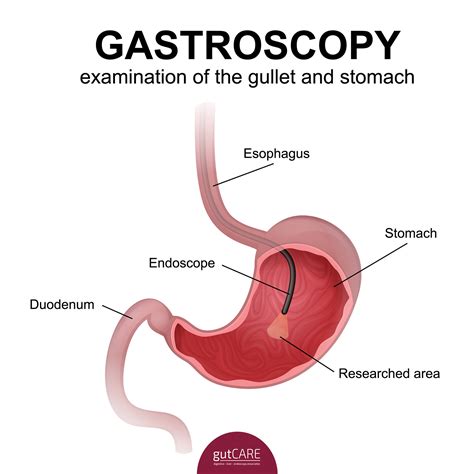 Upper Gastrointestinal Tract Diagram