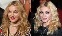 The Sun newspaper asks Dr Milojevic: What work has Madonna had done on ...