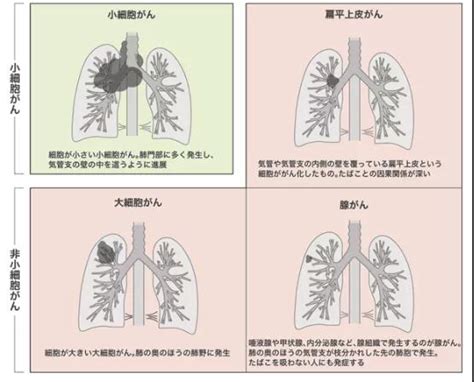 日本权威肺癌专家久保田馨：肺癌个体化治疗的效果更佳-厚朴方舟
