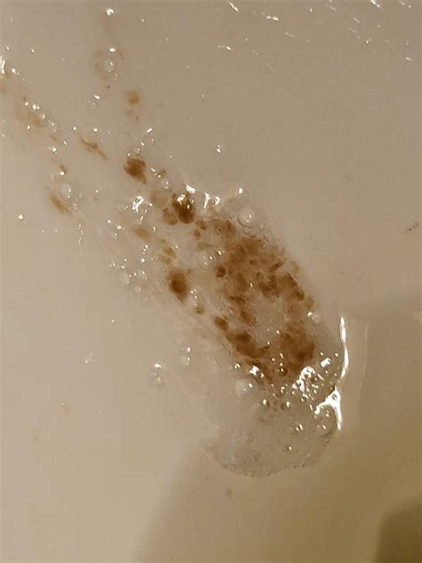 Dark Brown Mucus Discharge Brown Discharge: Possible Causes And