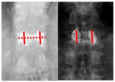 Diagnostics | Special Issue : Advanced Diagnostic and Surgical ...