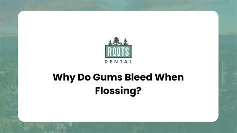 Why Do Gums Bleed When Flossing? - Roots Dental