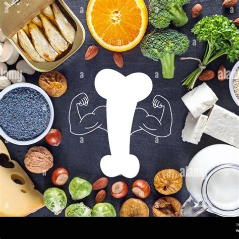 Bone Health – Risk Factors and Prevention of Osteoporosis ...