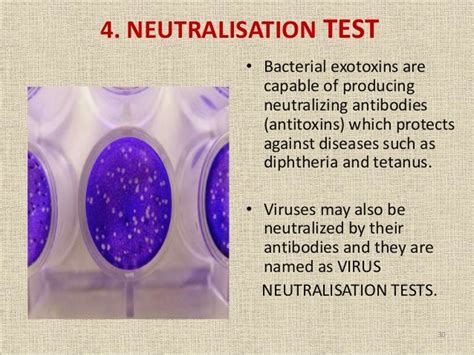 Neutralization Test 的图像结果