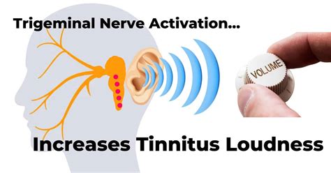 TMJ And Tinnitus: The #1 Comprehensive Guide | NeuroMed Tinnitus Care