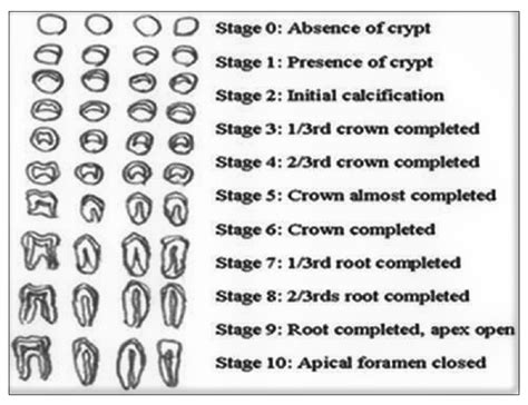 Dental Age Estimation Using Deep Learning: A Comparative Survey