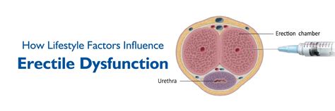 Understanding Erectile Dysfunction: Lifestyle Factors