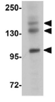 Anti-PRDM16 Antibody from rabbit, purified by affinity chromatography ...