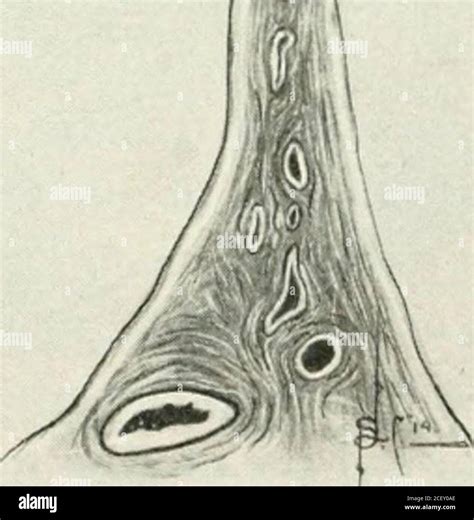 . A manual of gynæcology and pelvic surgery, for students and ...
