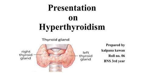 Image result for hyperthyroidism