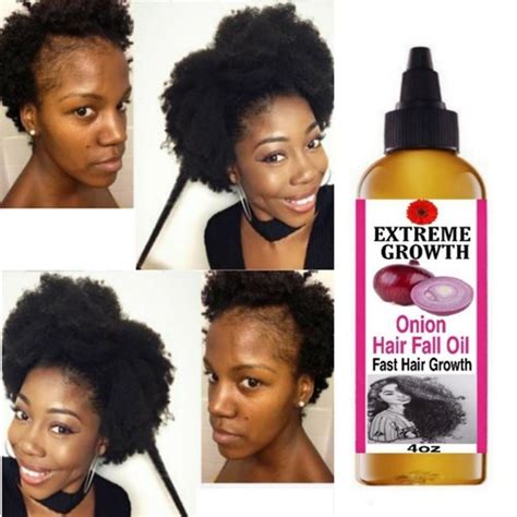 Extreme Hair Growth Oil, Fast Edges Growth Oil, India | Ubuy