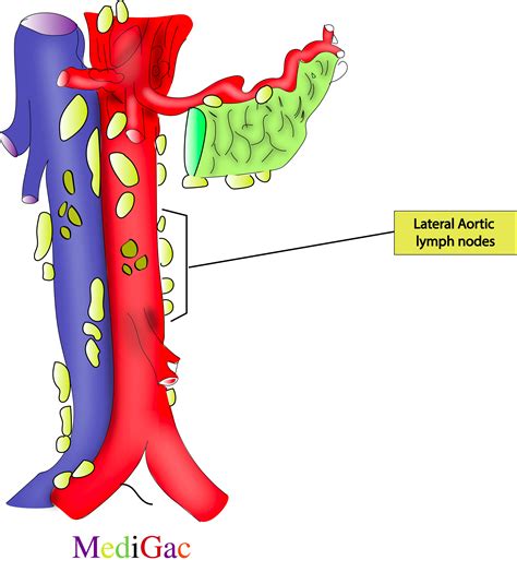 What are the lymph nodes of the Abdomen – MediGac