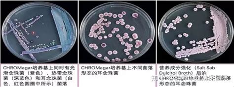 中國已有18例確認感染的「超級真菌」耳念珠菌是什麼？如何預防？ - 每日頭條