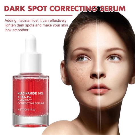Dark Spot Correcting Serum, 10% Niacinamide+ 4% Tranexamic Acid Serum ...