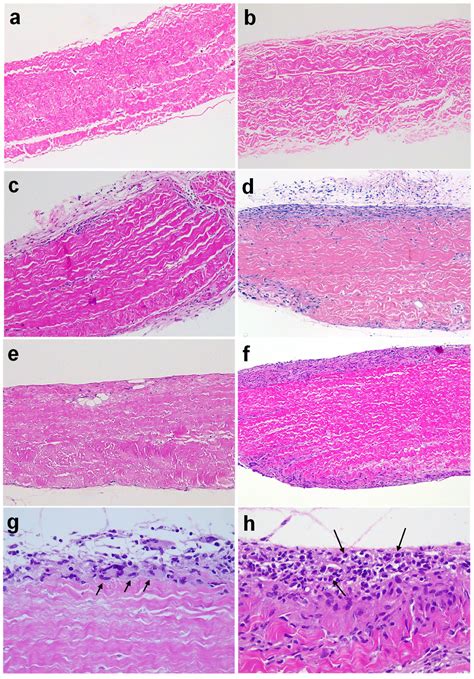 Differential Immune Response to Bioprosthetic Heart Valve Tissues in ...