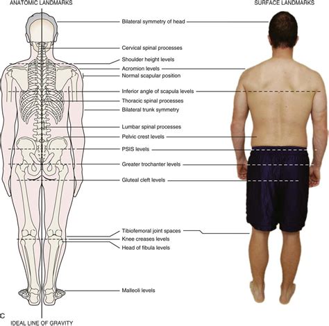 Image result for Normal Posture