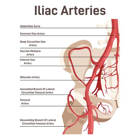 What Is Internal Iliac Artery