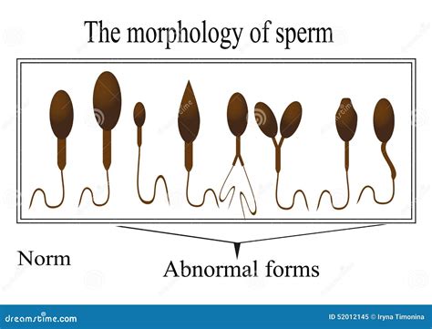 The Morphology of the Sperm. Normal and Abnormal Stock Vector ...