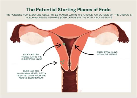 Image result for Endometrium Cell