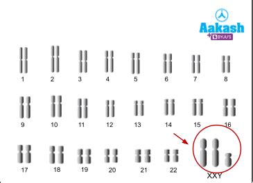 Chromosomal Disorders: Types, Symptoms & Chromosomal Disorders ...