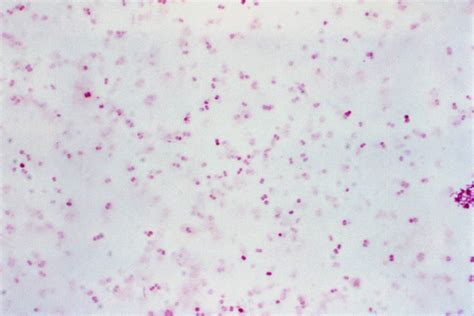 Diplococcus Gonorrhea