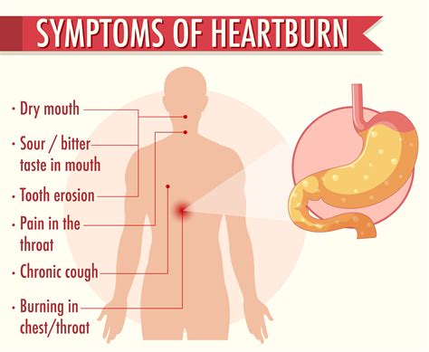 Symptoms Of Heartburn
