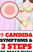 Image result for Candida Albicans Symptoms in Women