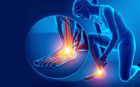 Foot Drop Overview: Symptoms, Diagnosis, & Treatments | IFAR