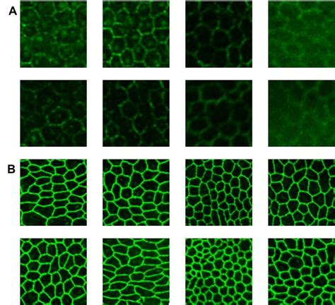 Image result for RPE Hexagonal Structure