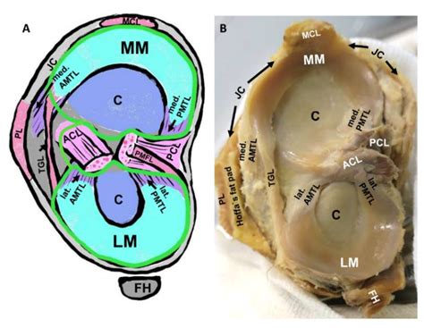 Intraarticular Ligament Degeneration Is Interrelated with Cartilage and ...