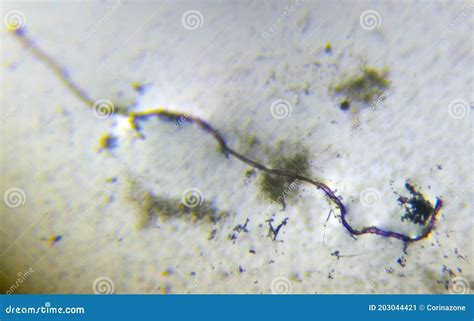 Penicillium Mold Under the Microscope Stock Image - Image of mold ...