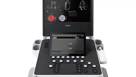 Philips - 5500CV HC795141 Philips Compact Ultrasound System
