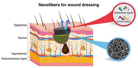 Wound Dressing with Electrospun Core-Shell Nanofibers: From Material Selection to Synthesis