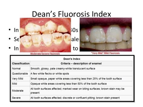 https://image.slidesharecdn.com/105dentalfluorosismeasring-140119140655-phpapp02/95/dental-fluorosis-19-638.jpg?cb=1390165387