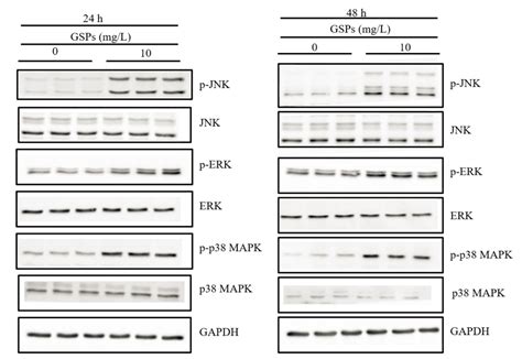 Grape Seed Proanthocyanidins Induce Apoptosis and Cell Cycle Arrest of ...