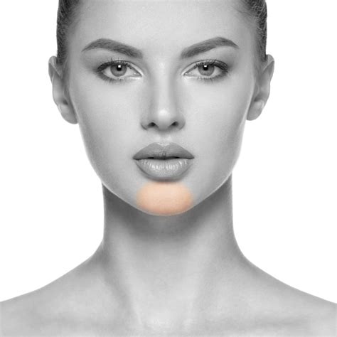 Is Laser Good For Chin Hair Removal at Allyson Byerly blog