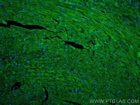 Testin antibody (10258-1-AP) | Proteintech