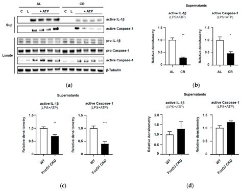 Does Calorie Restriction Modulate Inflammaging via FoxO Transcription ...