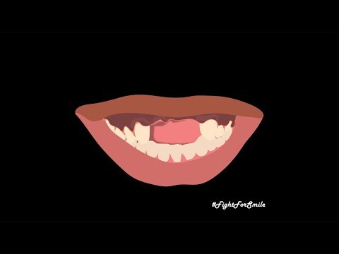 EPISODE 32 • Extreme Teeth Clicking for Relaxation & Mindfulness 🧘‍♂️✨ | Play Clicky Tooth!