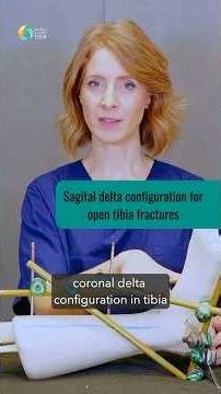 Two Experts, Two Solutions in Complex Tibia Fractures #fracturefixation